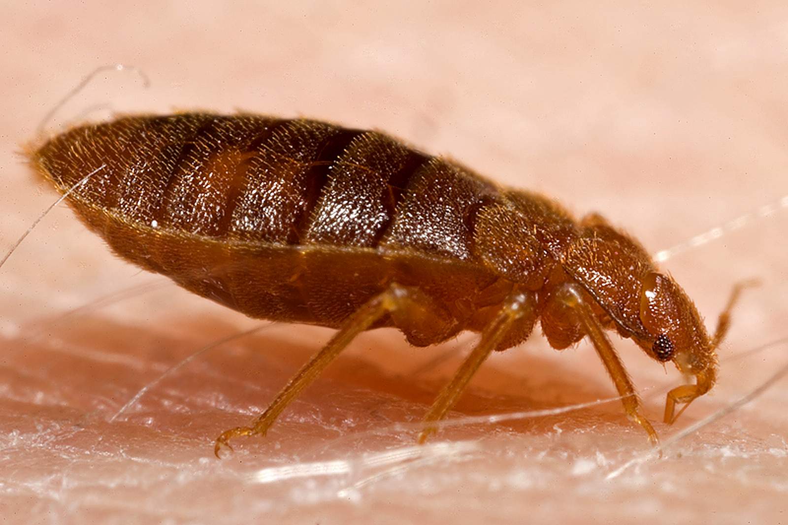 local bed bug removal